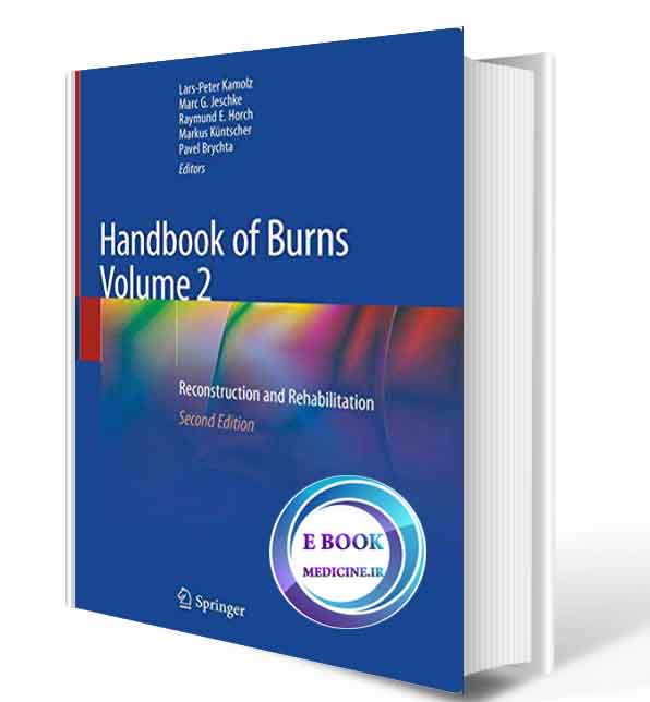 دانلود کتابHandbook of Burns Volume 2: Reconstruction and Rehabilitation2020(ORIGINAL PDF)